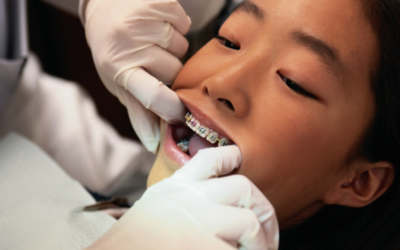 ¿Cómo saber si mi hijo necesita ortodoncia?