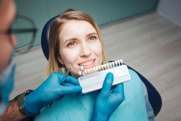 Carillas dentales cuánto duran: Todo lo que debes saber