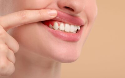 ¿Notas cambios en tus encías? Cómo influyen las hormonas en tu salud bucodental en Vitoria