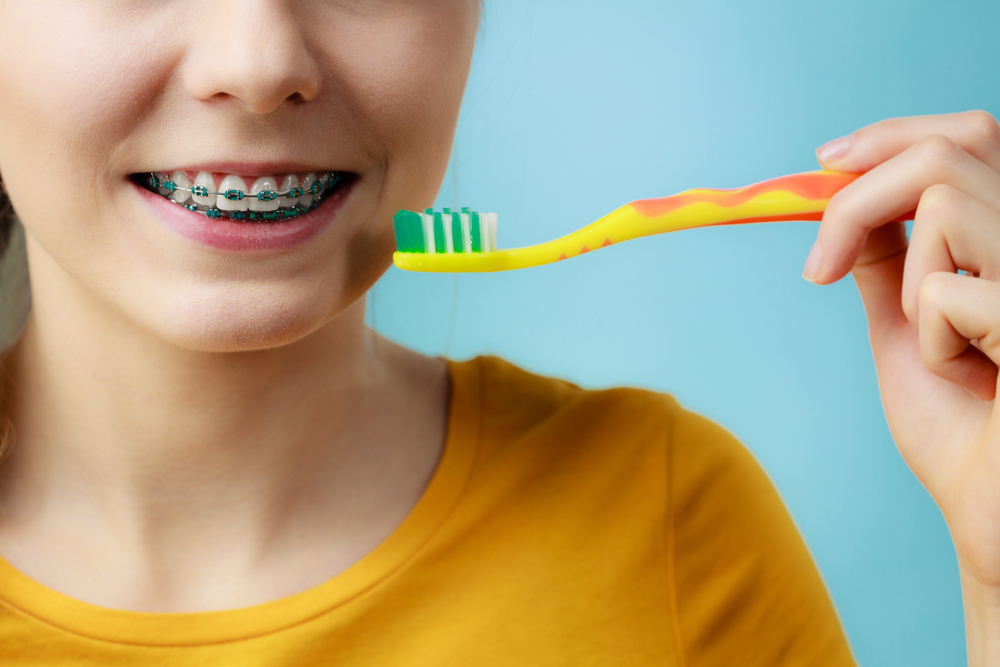 higiene dental con ortodoncia